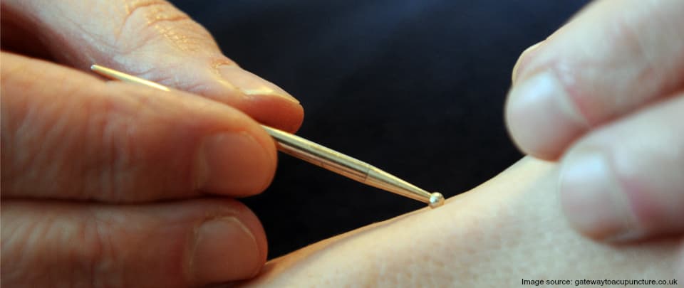 Careers Unusual - The Japanese Acupuncturist