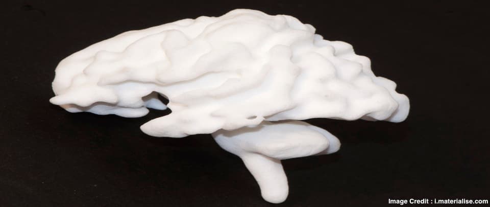 3D Printing and Neurosurgery