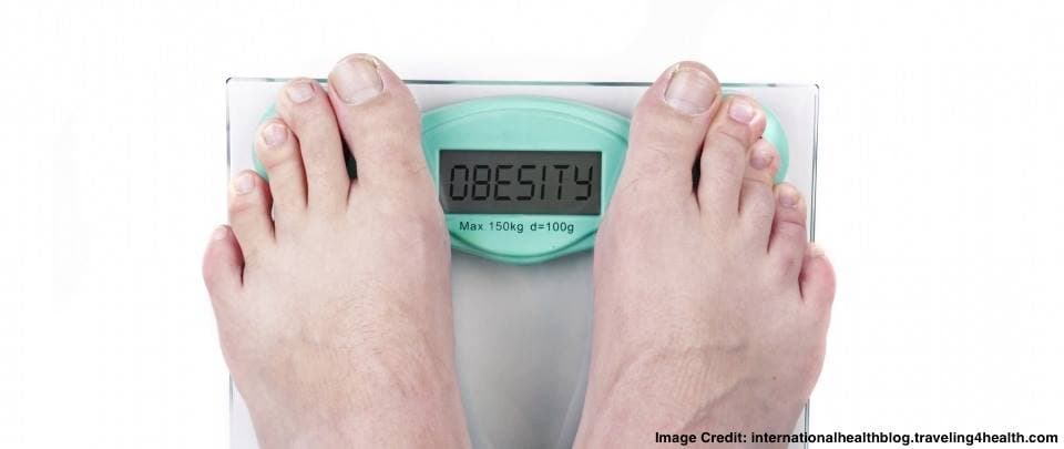 Weight Loss Surgery and Obesity