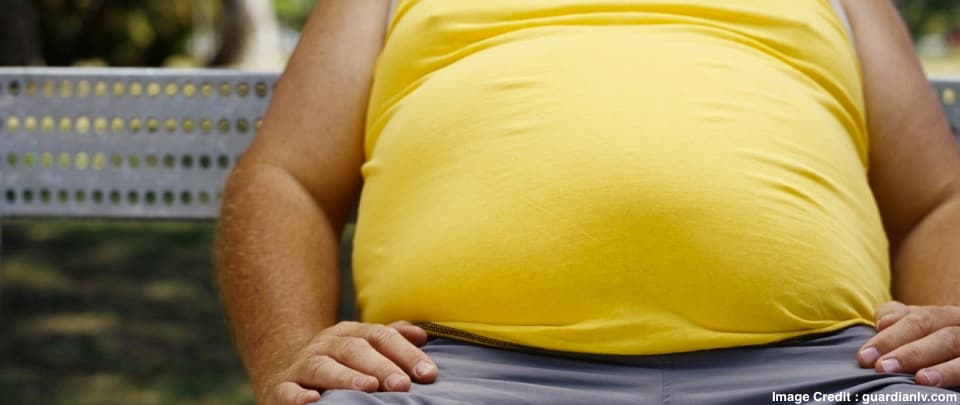 Obesity and Bariatric Surgery